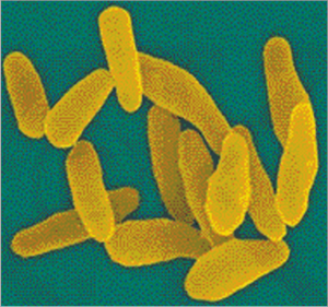 घटसर्प (Diphtheria)
