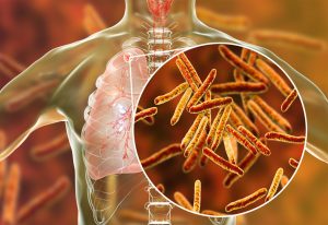 क्षयरोग जीवाणू  (Mycobacterium tuberculosis)