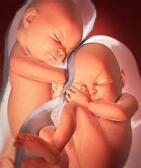 Read more about the article जुळे (Twins)