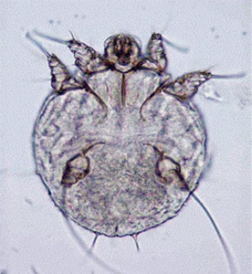 Read more about the article खरूज (Scabies)