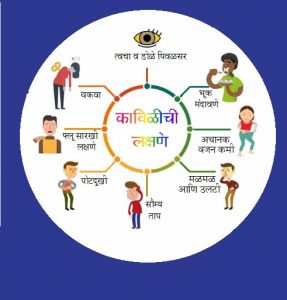 Read more about the article कावीळ (Jaundice)