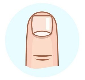 Read more about the article नखे (Nails)