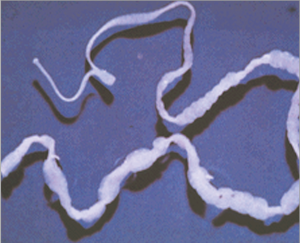 Read more about the article पट्टकृमी(Tape worm)