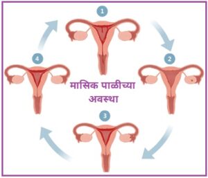 ऋतुस्राव व परिचर्या (Menstruation And Nursing)