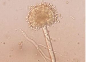 ॲस्परजिलस (Aspergillus)