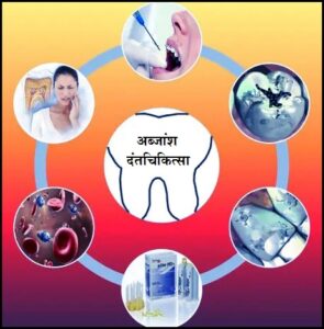 Read more about the article अब्जांश तंत्रज्ञान : दंतचिकित्सा (Nanotechnology in dentistry)