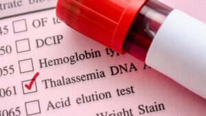 थॅलॅसेमिया (Thalassemia)