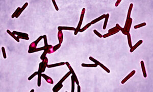 Read more about the article क्लॉस्ट्रिडियम बोट्युलिनम (Clostridium botulinum)