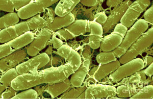 Read more about the article बॅसिलस थुरिंजेन्सीस (Bacillus thuringiensis)