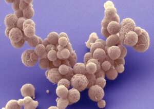 Read more about the article मायकोप्लाझ्मा लॅबोरेटोरियम (Mycoplasma laboratorium)