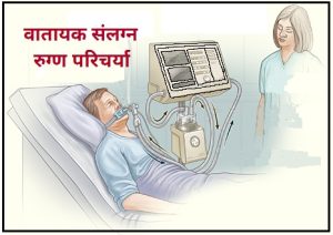 Read more about the article वातायक संलग्न रुग्ण परिचर्या (Ventilator attached patient care)