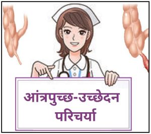 आंत्रपुच्छ-उच्छेदन परिचर्या (Appendectomy ‎Nursing)