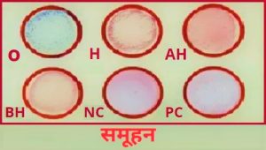 समूहन (Agglutination)