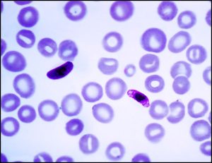 Read more about the article प्लास्मोडियम : जीवनचक्र (Plasmodium : life cycle)